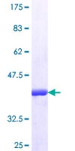 Novus Biologicals Recombinant Human SDS3 GST (N-Term) Protein 25 &mu;g | Buy Online | Novus Biologicals&trade; | Fisher Scientific