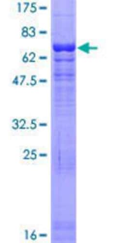 Novus Biologicals Recombinant Human ACTR6 GST (N-Term) Protein 10 &mu;g | Buy Online | Novus Biologicals&trade; | Fisher Scientific