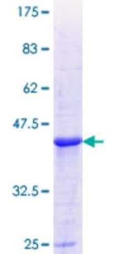 Novus Biologicals Recombinant Human ALDH8A1 GST (N-Term) Protein 10 &mu;g | Buy Online | Novus Biologicals&trade; | Fisher Scientific