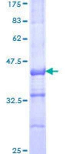 Novus Biologicals Recombinant Human GPR135 GST (N-Term) Protein 10 &mu;g | Buy Online | Novus Biologicals&trade; | Fisher Scientific