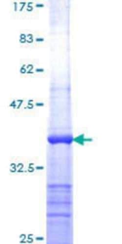 Novus Biologicals Recombinant Human Apc1 GST (N-Term) Protein 25 &mu;g | Buy Online | Novus Biologicals&trade; | Fisher Scientific