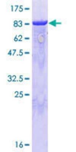 Novus Biologicals Recombinant Human GRASP65 GST (N-Term) Protein 10 &mu;g | Buy Online | Novus Biologicals&trade; | Fisher Scientific