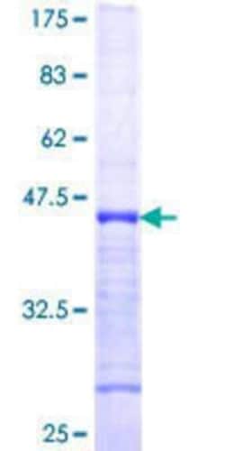 Novus Biologicals Recombinant Human GRASP65 GST (N-Term) Protein 25 &mu;g | Buy Online | Novus Biologicals&trade; | Fisher Scientific