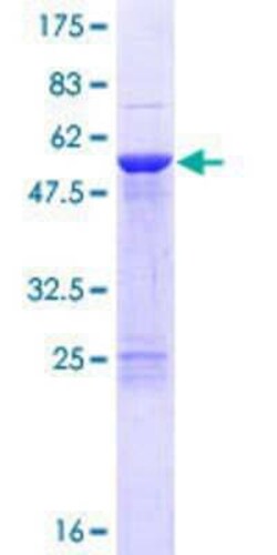 Novus Biologicals Recombinant Human CSN7b GST (N-Term) Protein 25 &mu;g | Buy Online | Novus Biologicals&trade; | Fisher Scientific
