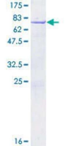 Novus Biologicals Recombinant Human NUCKS1 GST (N-Term) Protein 10 &mu;g | Buy Online | Novus Biologicals&trade; | Fisher Scientific