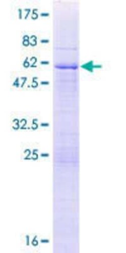 Novus Biologicals Recombinant Human UNKL GST (N-Term) Protein 25 &mu;g | Buy Online | Novus Biologicals&trade; | Fisher Scientific