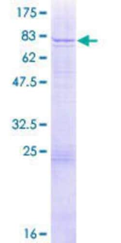 Novus Biologicals Recombinant Human WDR13 GST (N-Term) Protein 2 &mu;g | Buy Online | Novus Biologicals&trade; | Fisher Scientific