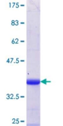Novus Biologicals Recombinant Human WDR13 GST (N-Term) Protein 10 &mu;g | Buy Online | Novus Biologicals&trade; | Fisher Scientific