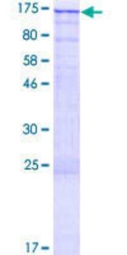 Novus Biologicals Recombinant Human ZNF574 GST (N-Term) Protein 10 &mu;g | Buy Online | Novus Biologicals&trade; | Fisher Scientific