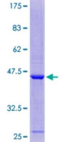 Novus Biologicals&trade;&nbsp;Recombinant Human C11orf1 GST (N-Term) Protein