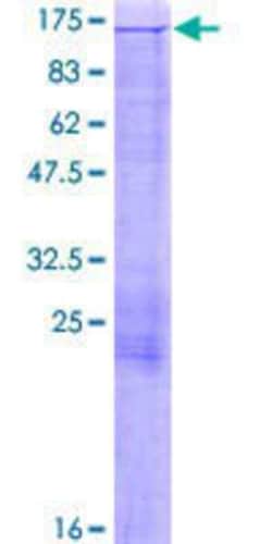 Novus Biologicals Recombinant Human MICAL1 GST (N-Term) Protein 2 &mu;g | Buy Online | Novus Biologicals&trade; | Fisher Scientific