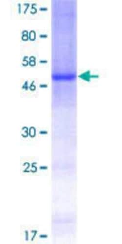 Novus Biologicals&trade;&nbsp;Recombinant Human Ceramide Kinase GST (N-Term) Protein