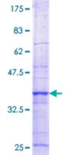 Novus Biologicals Recombinant Human RBM15 GST (N-Term) Protein 10 &mu;g | Buy Online | Novus Biologicals&trade; | Fisher Scientific