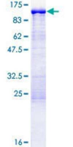 Novus Biologicals&trade;&nbsp;Recombinant Human EPS8L2 GST (N-Term) Protein