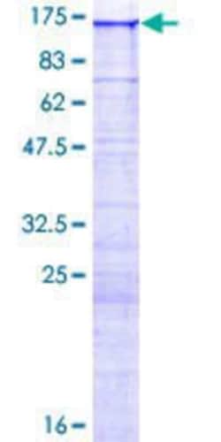 Novus Biologicals Recombinant Human IQCH GST (N-Term) Protein 10 &mu;g | Buy Online | Novus Biologicals&trade; | Fisher Scientific