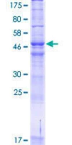 Novus Biologicals Recombinant Human ARV1 GST (N-Term) Protein 10 &mu;g | Buy Online | Novus Biologicals&trade; | Fisher Scientific