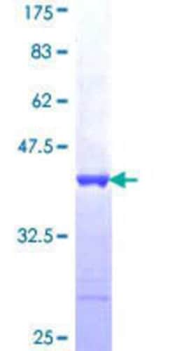 Novus Biologicals Recombinant Human FNDC4 GST (N-Term) Protein 25 &mu;g | Buy Online | Novus Biologicals&trade; | Fisher Scientific