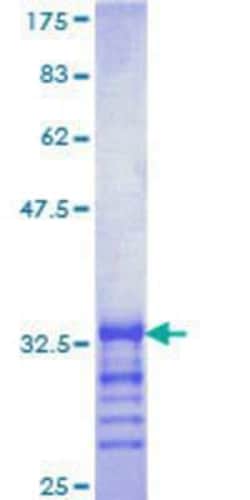 Novus Biologicals Recombinant Human Axotrophin GST (N-Term) Protein 10 &mu;g | Buy Online | Novus Biologicals&trade; | Fisher Scientific