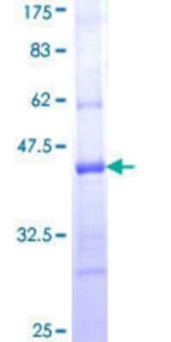 Novus Biologicals Recombinant Human PCDH20 GST (N-Term) Protein 25 &mu;g | Buy Online | Novus Biologicals&trade; | Fisher Scientific