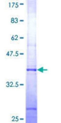 Novus Biologicals Recombinant Human AGXT2 GST (N-Term) Protein 25 &mu;g | Buy Online | Novus Biologicals&trade; | Fisher Scientific