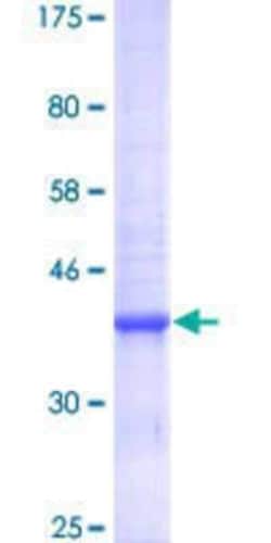 Novus Biologicals Recombinant Human SLC30A5 GST (N-Term) Protein 25 &mu;g | Buy Online | Novus Biologicals&trade; | Fisher Scientific