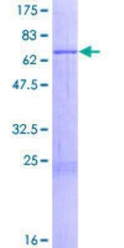 Novus Biologicals Recombinant Human MRPS9 GST (N-Term) Protein 25 &mu;g | Buy Online | Novus Biologicals&trade; | Fisher Scientific