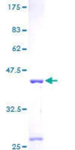 Novus Biologicals Recombinant Human MRPS6 GST (N-Term) Protein 2 &mu;g | Buy Online | Novus Biologicals&trade; | Fisher Scientific