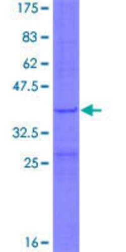Novus Biologicals&trade;&nbsp;Recombinant Human MRPL34 GST (N-Term) Protein