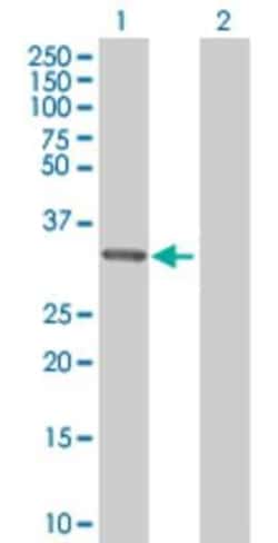 Novus Biologicals&trade;&nbsp;MRPL1 293T Cell Transient Overexpression Lysate