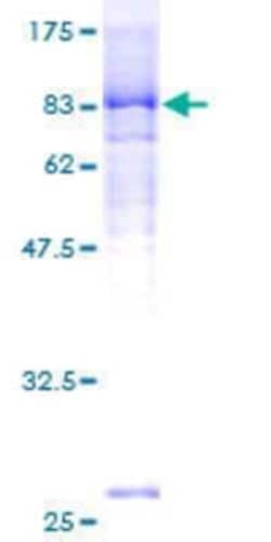 Novus Biologicals Recombinant Human ACD GST (N-Term) Protein 25 &mu;g | Buy Online | Novus Biologicals&trade; | Fisher Scientific