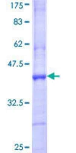 Novus Biologicals Recombinant Human PTOP GST (N-Term) Protein 10 &mu;g | Buy Online | Novus Biologicals&trade; | Fisher Scientific