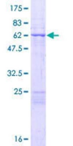 Novus Biologicals Recombinant Human MRPL44 GST (N-Term) Protein 10 &mu;g | Buy Online | Novus Biologicals&trade; | Fisher Scientific
