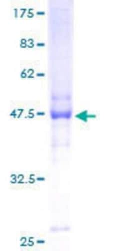 Novus Biologicals&trade;&nbsp;Recombinant Human NOL6 GST (N-Term) Protein