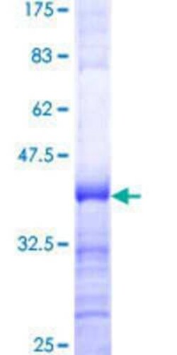 Novus Biologicals Recombinant Human UPF3A GST (N-Term) Protein 25 &mu;g | Buy Online | Novus Biologicals&trade; | Fisher Scientific