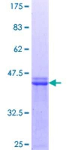 Novus Biologicals Recombinant Human UPF3A GST (N-Term) Protein 10 &mu;g | Buy Online | Novus Biologicals&trade; | Fisher Scientific