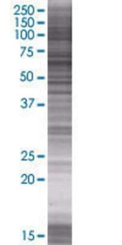 Novus Biologicals UPF3A 293T Cell Transient Overexpression Lysate 0.1 mL | Buy Online | Novus Biologicals&trade; | Fisher Scientific