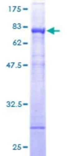 Novus Biologicals Recombinant Human NADK GST (N-Term) Protein 25 &mu;g | Buy Online | Novus Biologicals&trade; | Fisher Scientific