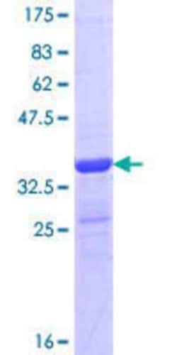 Novus Biologicals Recombinant Human WNK4 GST (N-Term) Protein 10 &mu;g | Buy Online | Novus Biologicals&trade; | Fisher Scientific