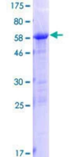 Novus Biologicals Recombinant Human PLEKHA3 GST (N-Term) Protein 25 &mu;g | Buy Online | Novus Biologicals&trade; | Fisher Scientific