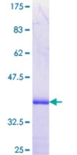Novus Biologicals Recombinant Human PLEKHA3 GST (N-Term) Protein 10 &mu;g | Buy Online | Novus Biologicals&trade; | Fisher Scientific