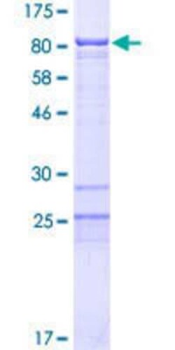 Novus Biologicals Recombinant Human BRD9 GST (N-Term) Protein 2 &mu;g | Buy Online | Novus Biologicals&trade; | Fisher Scientific