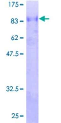 Novus Biologicals Recombinant Human ZNF447 GST (N-Term) Protein 10 &mu;g | Buy Online | Novus Biologicals&trade; | Fisher Scientific