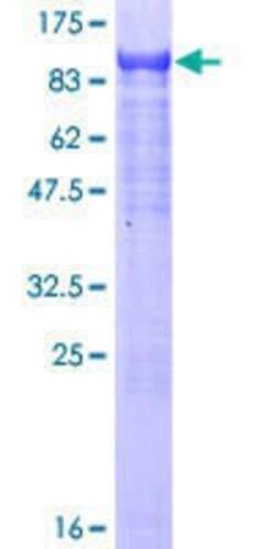 Novus Biologicals Recombinant Human ZNF447 GST (N-Term) Protein 10 &mu;g | Buy Online | Novus Biologicals&trade; | Fisher Scientific