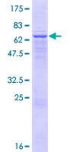 Novus Biologicals Recombinant Human Acetoacetyl CoA synthetase GST (N-Term) Protein 25 &mu;g | Buy Online | Novus Biologicals&trade; | Fisher Scientific