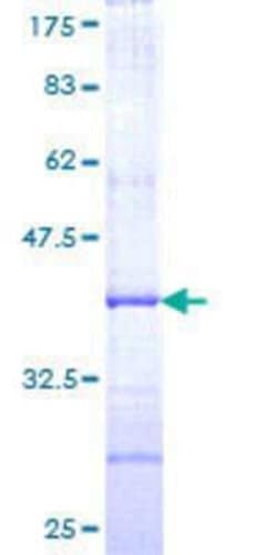 Novus Biologicals Recombinant Human Acetoacetyl CoA synthetase GST (N-Term) Protein 10 &mu;g | Buy Online | Novus Biologicals&trade; | Fisher Scientific