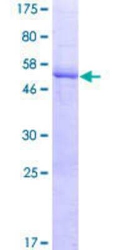 Novus Biologicals Recombinant Human LRRC61 GST (N-Term) Protein 10 &mu;g | Buy Online | Novus Biologicals&trade; | Fisher Scientific