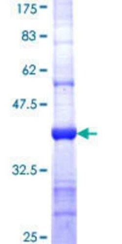 Novus Biologicals Recombinant Human MTMR9 GST (N-Term) Protein 25 &mu;g | Buy Online | Novus Biologicals&trade; | Fisher Scientific
