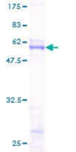 Novus Biologicals Recombinant Human SCNM1 GST (N-Term) Protein 25 &mu;g | Buy Online | Novus Biologicals&trade; | Fisher Scientific