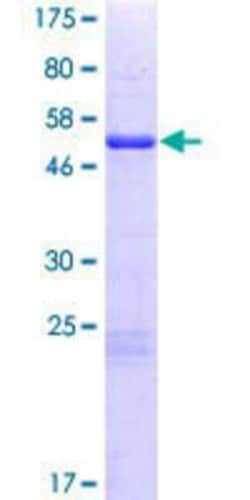 Novus Biologicals Recombinant Human OBFC2B GST (N-Term) Protein 25 &mu;g | Buy Online | Novus Biologicals&trade; | Fisher Scientific