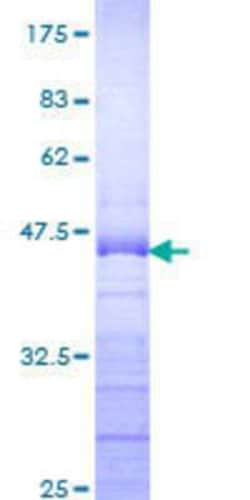 Novus Biologicals Recombinant Human DDX54 GST (N-Term) Protein 25 &mu;g | Buy Online | Novus Biologicals&trade; | Fisher Scientific
